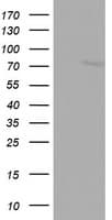 Monoclonal Mouse anti-Human FBXO11 Antibody (clone OTI1F6, aa1-300, WB)