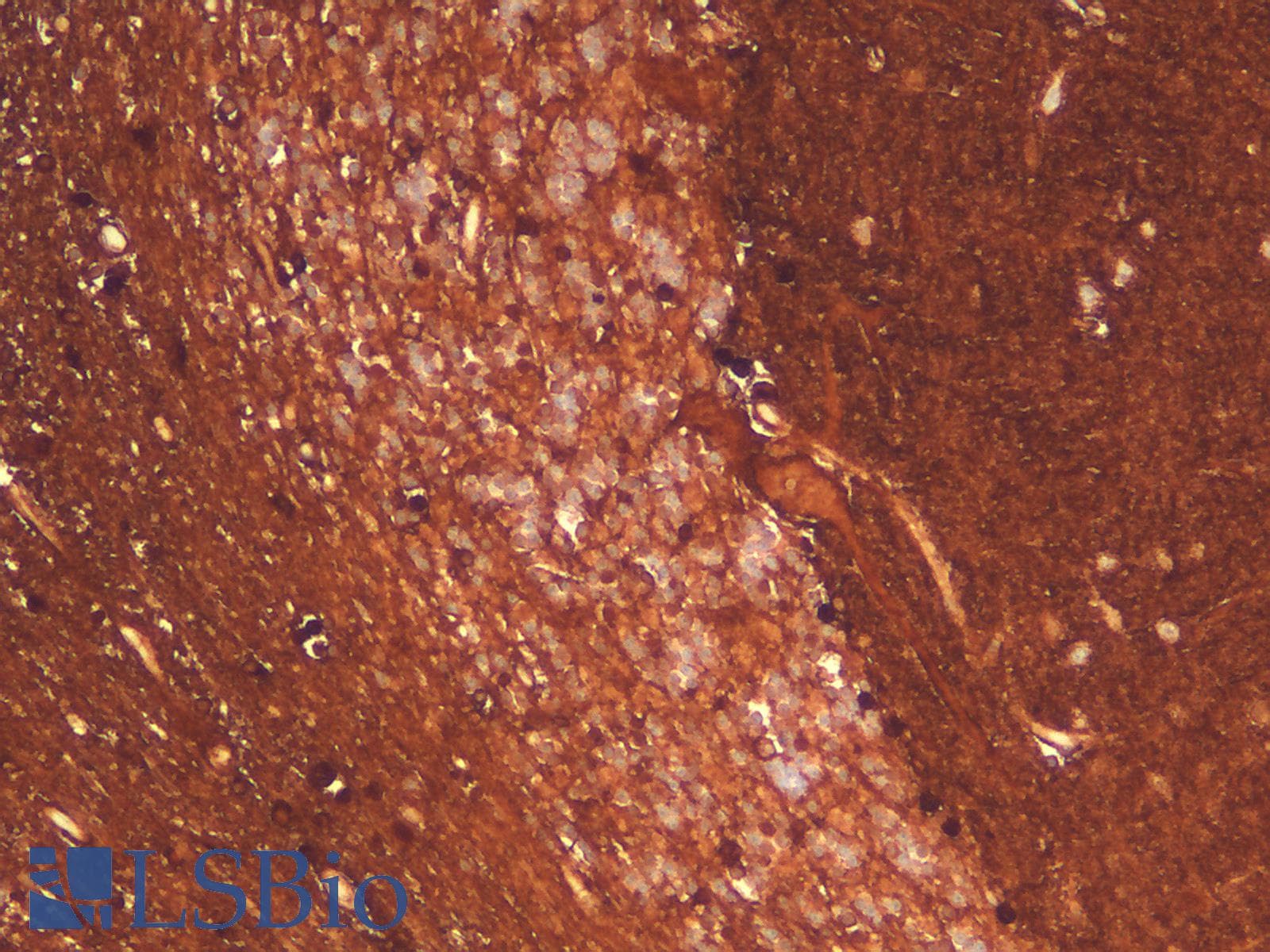 PathPlus™ Recombinant Monoclonal Rabbit anti-Human S100B / S100 Beta Antibody (clone S100B/1706R, IHC)