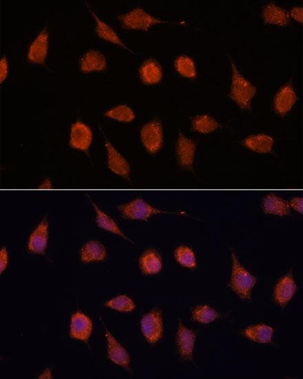 KCNAB2 / Kv-Beta-2 Antibody