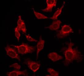 IL17A Antibody