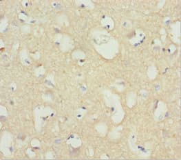 Polyclonal Rabbit anti-Human NCALD / Neurocalcin Delta Antibody (IHC)