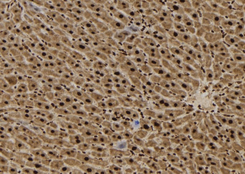 Polyclonal Rabbit anti-Human SFT2D3 Antibody (IHC, WB)