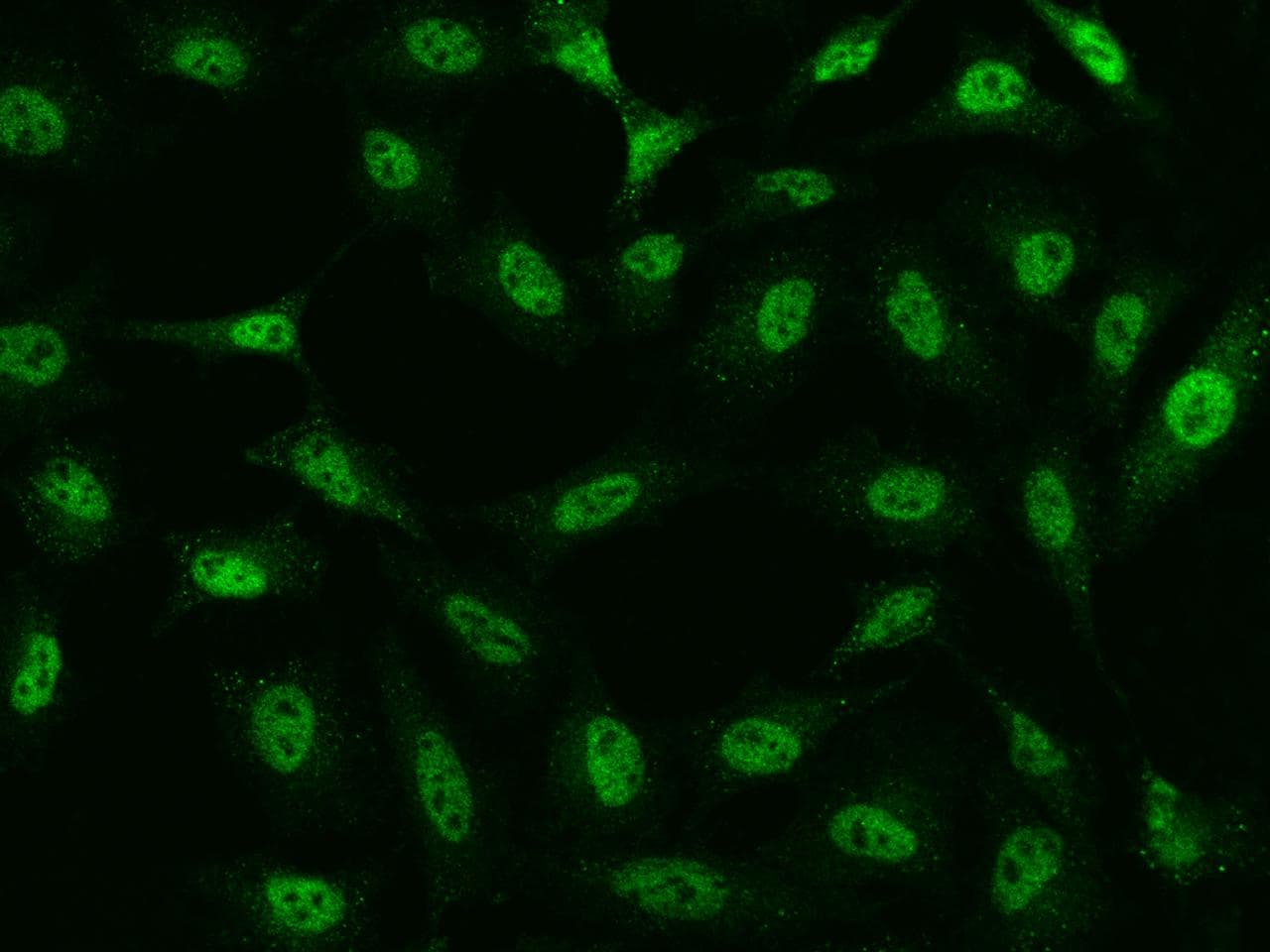 Polyclonal Rabbit anti-Human TATDN1 Antibody (IHC, IF)