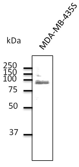 TLR2 Antibody (C-Terminus)