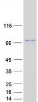 Human NDUFV3 Protein (Recombinant Myc-DDK (Flag))