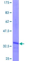 Human NODAL Protein (Recombinant GST, N-terminus)