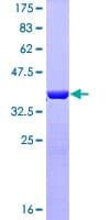 Human GFAP Protein (Recombinant GST, N-terminus)