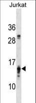 PFDN4 Antibody (aa4-32)