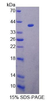 Mouse UP2 / UPP2 Protein (Recombinant His-T7, N-terminus)