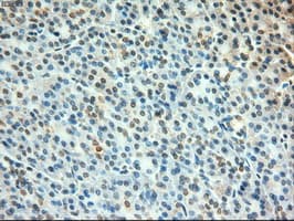 Monoclonal Mouse anti-Human MYC / c-Myc Antibody (clone OTI1A6, IHC, IF, WB)