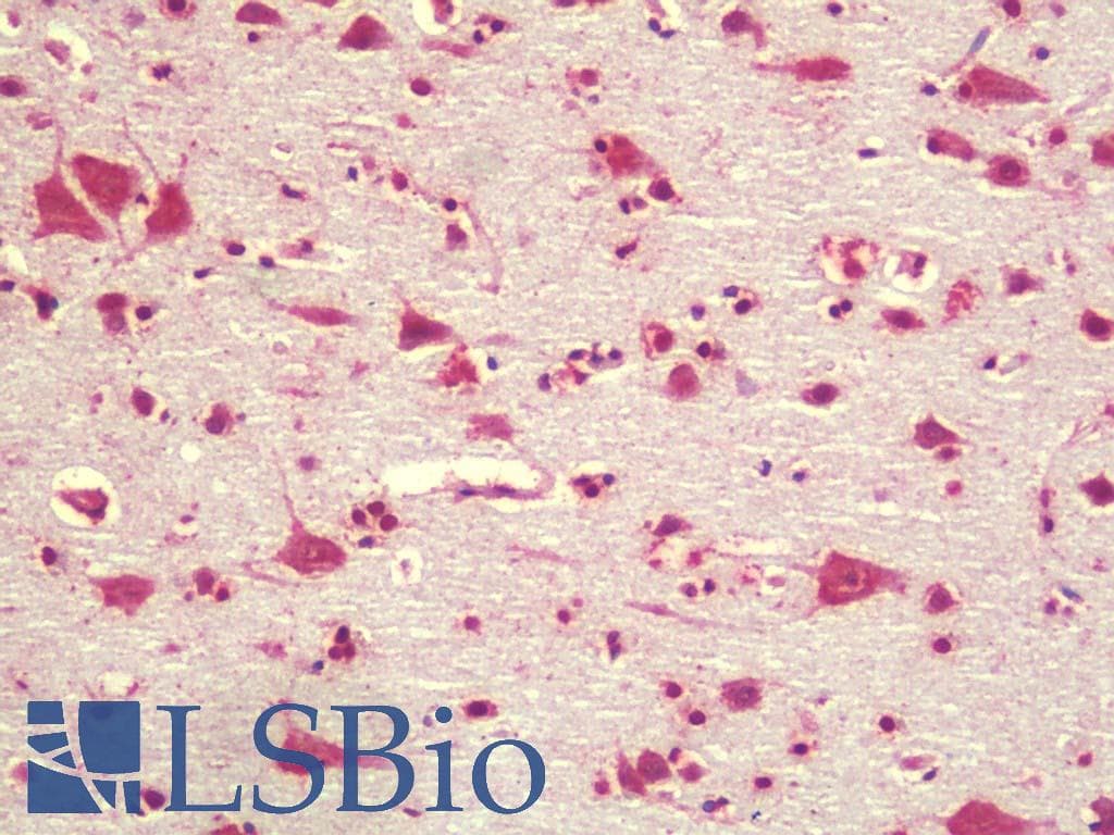 IHC-plus™ TGM7 / Transglutaminase 7 Antibody