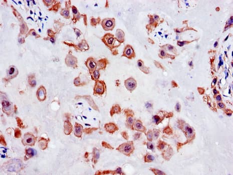 SLC18A1 / VMAT1 Antibody