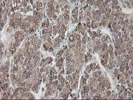 RPN1 / Ribophorin I Antibody (clone OTI3H3)