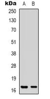 Polyclonal Rabbit anti-Human PPP1R14A / CPI-17 Antibody (N-Terminus, IHC, IF, WB)