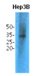 TPMT Antibody (clone AT2E7)