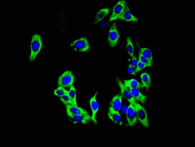 Polyclonal Rabbit anti-Human TWIK1 / KCNK1 Antibody (IHC, IF)