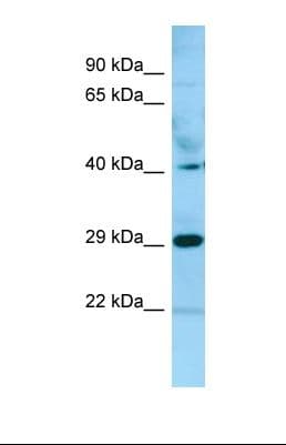 ANGPTL1 Antibody (C-Terminus)