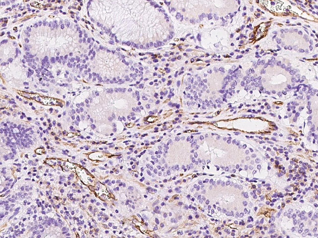 PECAM-1 / CD31 Antibody (Preservative Free)