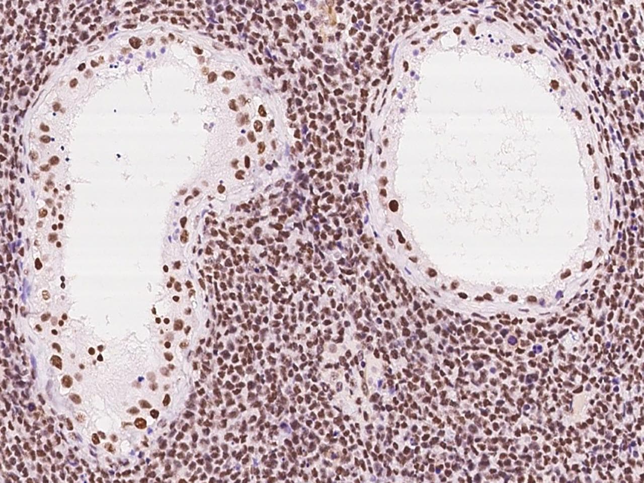 EWSR1 / EWS Antibody