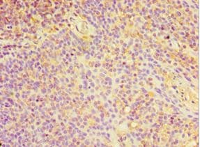 YKL39 / CHI3L2 Antibody (aa27-390)