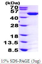 Human ASS1 / ASS Protein (Recombinant His)