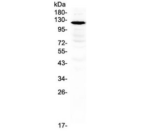 GRIN1 / NMDAR1 Antibody