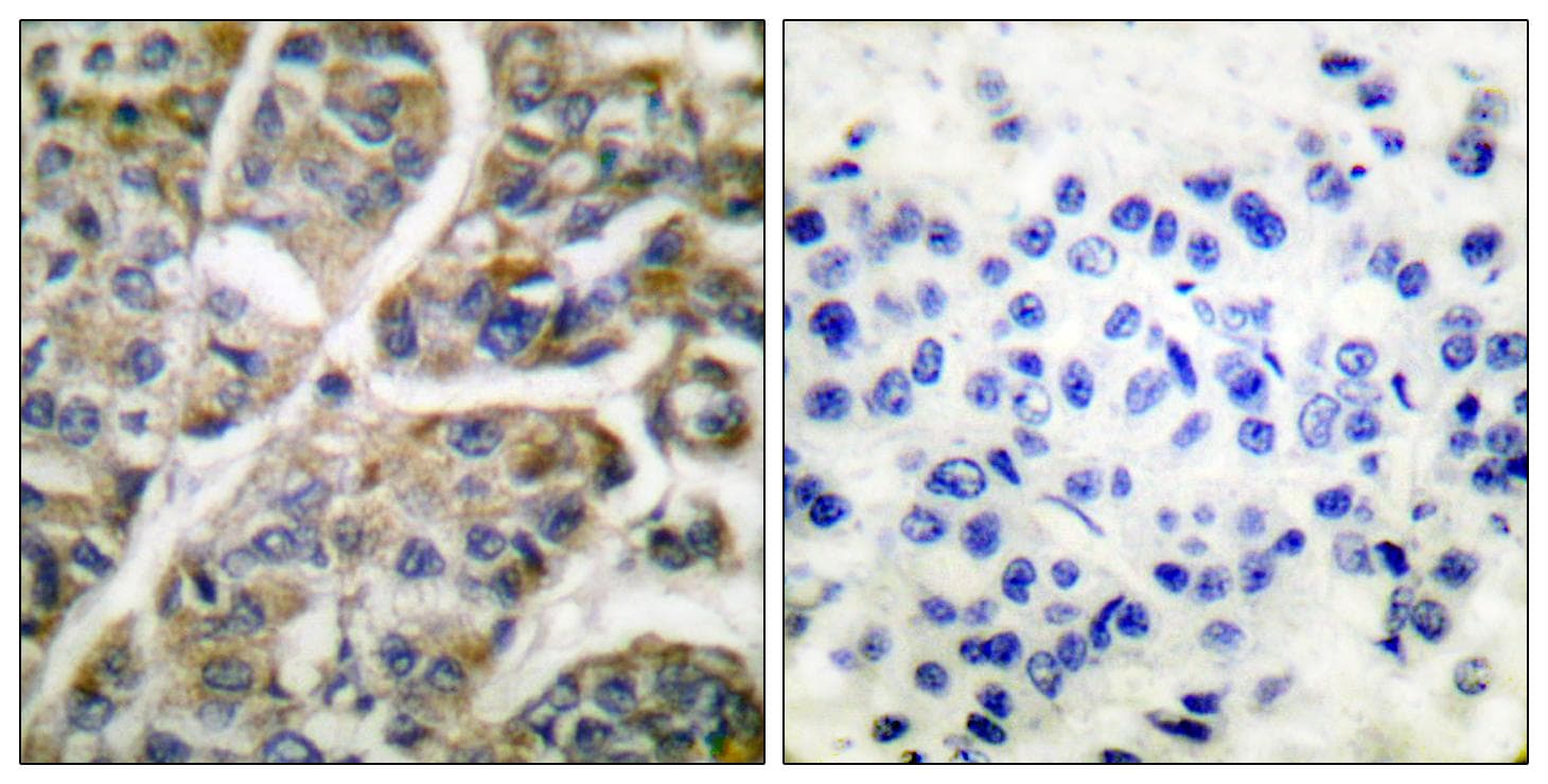 GZMB / Granzyme B Antibody