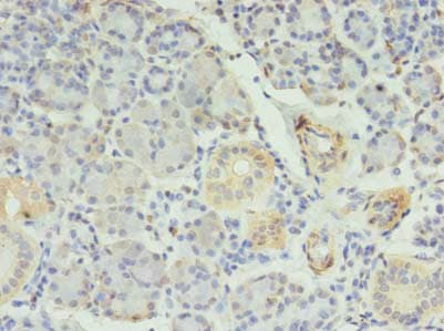 Polyclonal Rabbit anti-Human RFX6 Antibody (IHC)