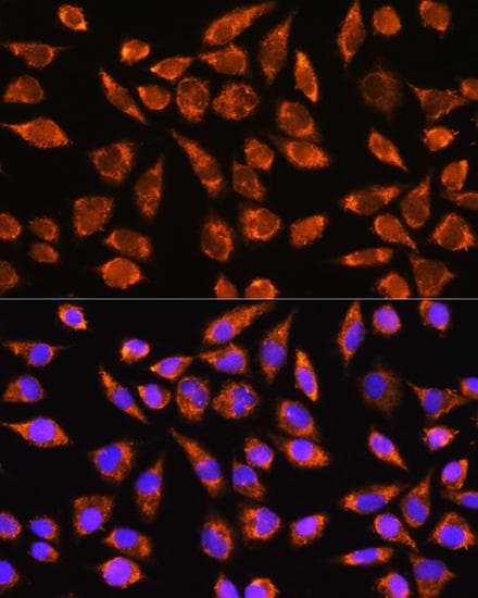 Polyclonal Rabbit anti-Human MARK2 Antibody (IF)