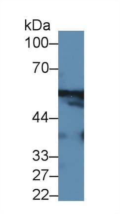 GPT / Alanine Transaminase Antibody (aa147-263, APC, Cy7)