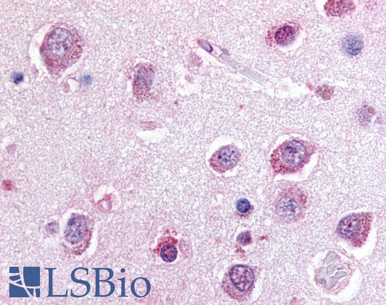IHC-plus™ Polyclonal Rabbit anti-Human P2RY8 / P2Y8 Antibody (C-Terminus, IHC)