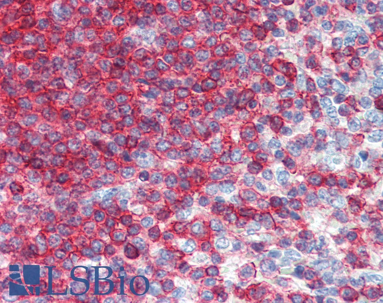 PathPlus™ CD44 Antibody (clone MEM-85)