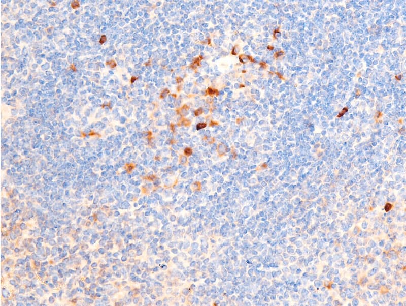 Polyclonal Rabbit anti-Human CHEK1 / CHK1 Antibody (phospho-Ser317, IHC, IF, WB)