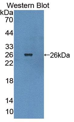 CML / BCR Antibody (aa1042-1243)