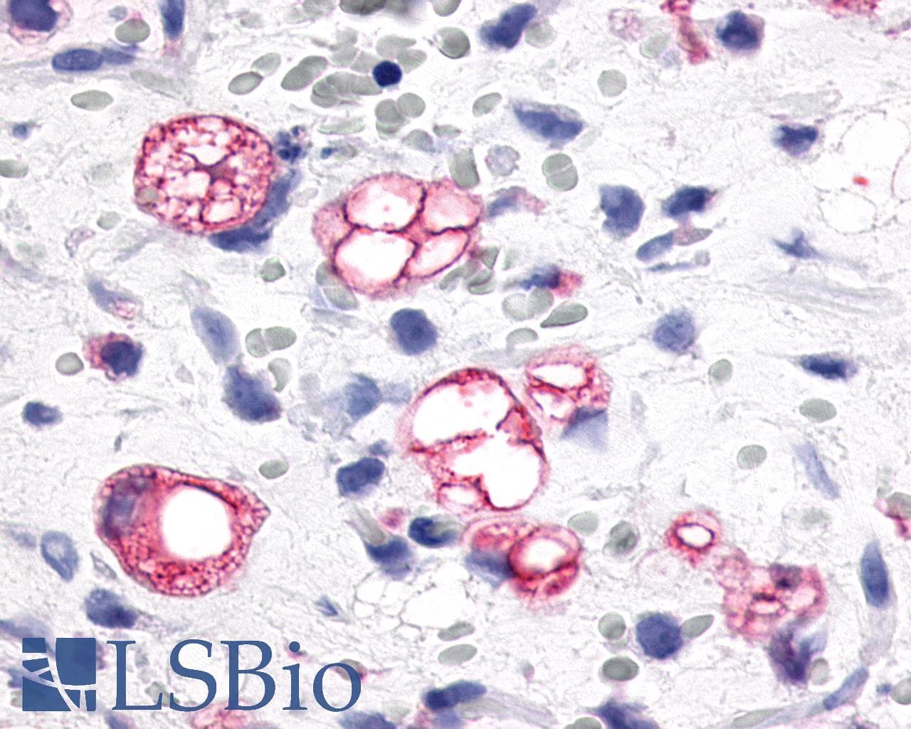 IHC-plus™ Polyclonal Rabbit anti-Human MCHR1 Antibody (N-Terminus, IHC)