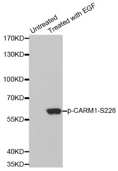 PRMT4 / CARM1 Antibody (phospho-Ser228)