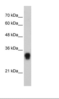 RPL8 / Ribosomal Protein L8 Antibody (C-Terminus)