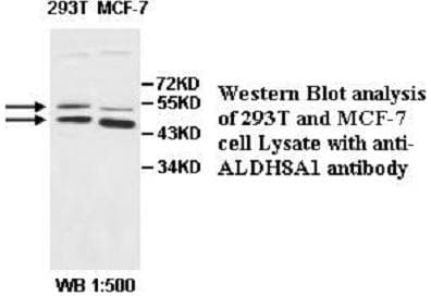 ALDH8A1 Antibody (aa287-487)