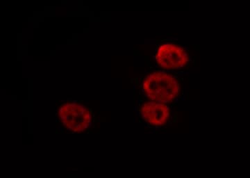 CAMK4 / CaMK IV Antibody