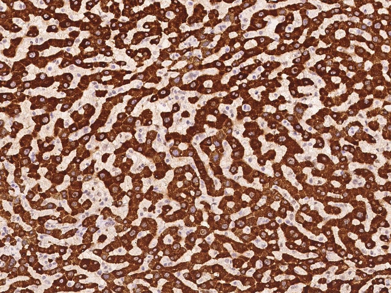 SLC27A5 / BACS Antibody