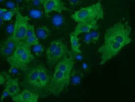 IGF2BP2 Antibody (clone OTI2H7)
