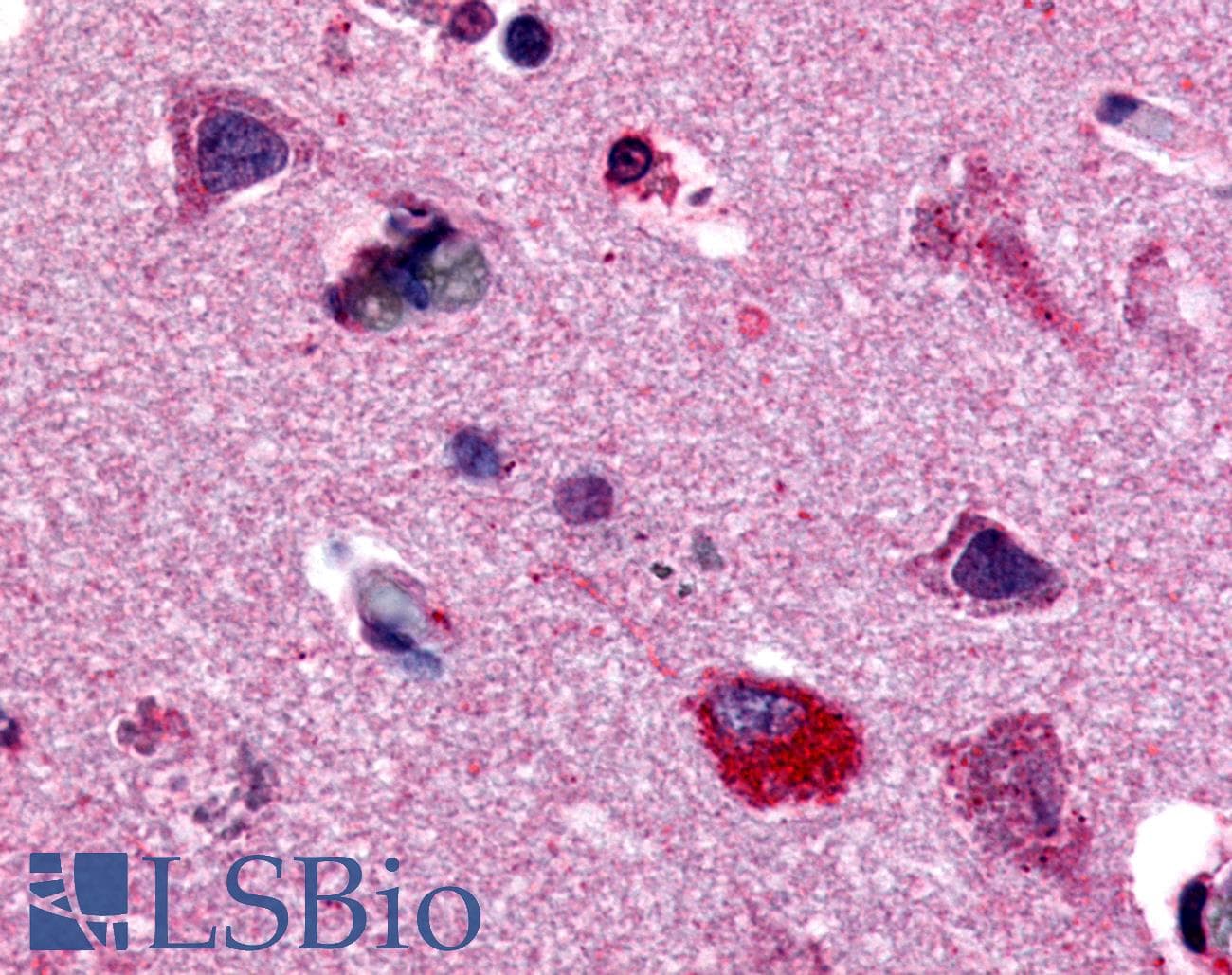 PathPlus™ MAPK3 / ERK1 Antibody (Internal)