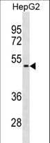 Polyclonal Rabbit anti-Human NEU1 / NEU Antibody (aa188-214, WB)