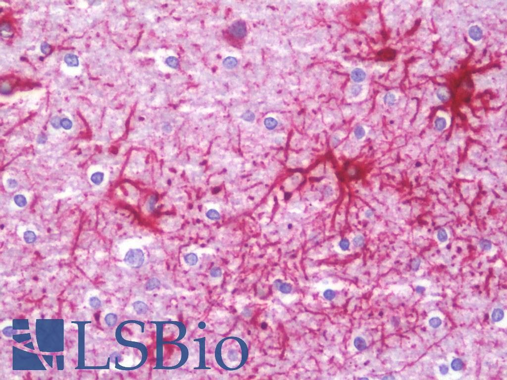 IHC-plus™ JAKMIP1 Antibody