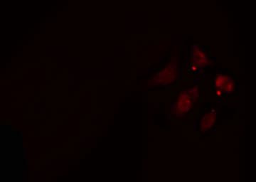 Polyclonal Rabbit anti-Human ADD3 Antibody (IF, WB)