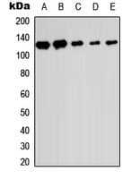 SENP6 Antibody (C-Terminus)