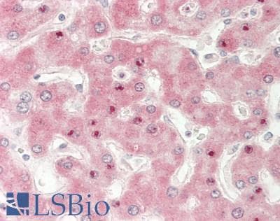 Polyclonal Rabbit anti-Human ADIPOR2 Antibody (C-Terminus, IHC, WB)