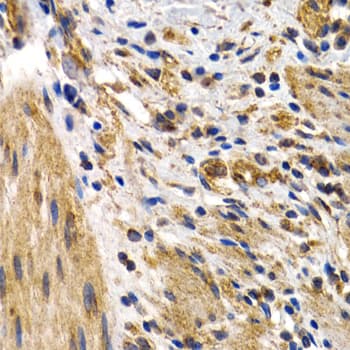 Polyclonal Rabbit anti-Human HSPB8 / H11 / HSP22 Antibody (IHC, IF, WB)