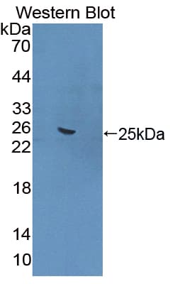 FNBP1 / FBP17 Antibody (aa348-529)