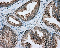 PIM2 / Pim-2 Antibody (clone OTI8H10)